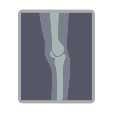 Knee x ray image semi flat color vector object Illustrazione stock