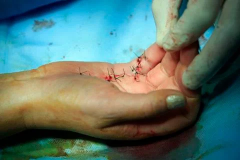 Knots on a hand Photos