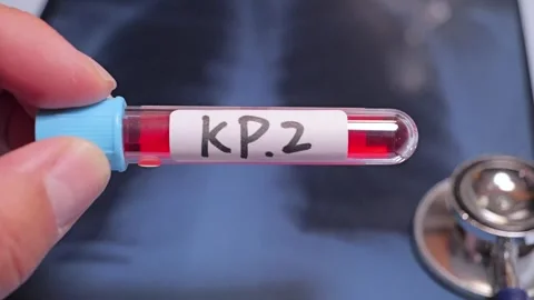 KP.2 is one of several variants being referred to as “FLiRT variants” Stock-Footage 275348200