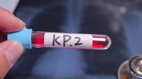 KP.2 is one of several variants being referred to as “FLiRT variants” Stock-Footage 275348201