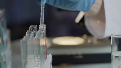 Lab assistant looking for antibodies in blood, test on HIV infection, analysis Stock Footage 73955632