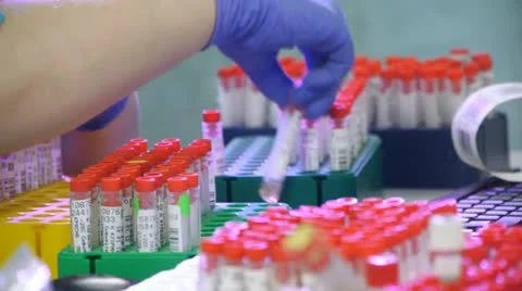 Lab Assistant prepares test tubes with analysis Stock Footage 12363383