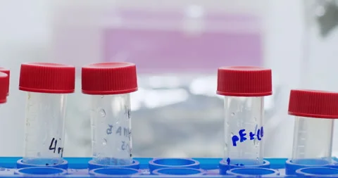 Lab assistant takes test tube with yellow liquid from rack Vídeos de archivo 273314072
