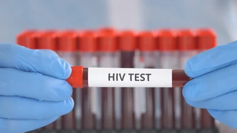 Lab assistant wearing protective gloves holds laboratory tube with HIV test Stock Footage 126733930