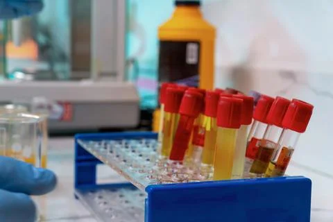 A lab bench with a tray of test tubes and a bottle of yellow liquid Stock Photos