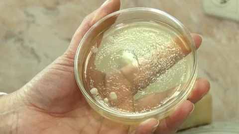 Lab petri dish with yellow microorganisms at the laboratory assistant. Video stock 127321007