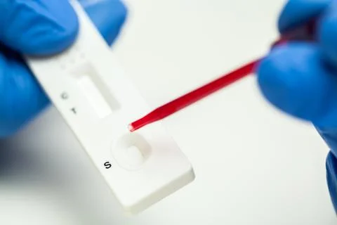 Lab scientist performing rapid diagnostic test Stock Photos