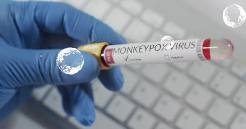 Lab tech holding monkeypox virus tube over keyboard initiating bubble graphics Stock Footage 317793297