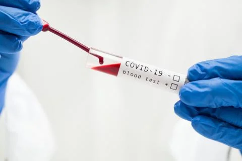Lab technician dropping blood sample in test tube container using pipette Stock Photos