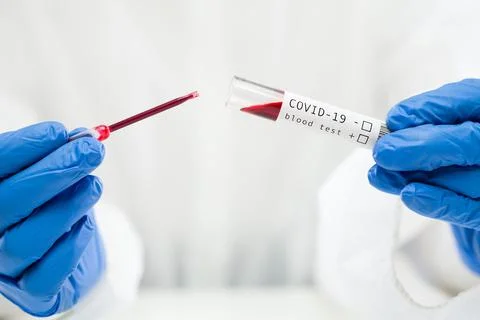 Lab technician dropping blood sample in test tube container using pipette Stock Photos