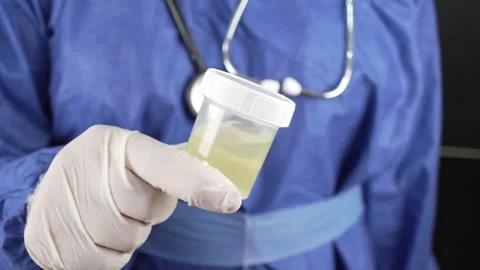 Lab Technician Extends Urine Specimen Cup Toward Camera Stock Footage 340580222