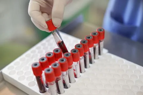 Lab technician hand checking patient blood tube before submitting test, selec Stock Photos