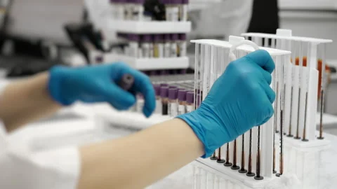 Lab technician isolating red blood cells with pipette in hematology laboratory. Stockbeeldmateriaal 320885154