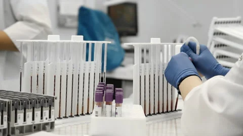 Lab technician isolating red blood cells with pipette in hematology laboratory. Vídeo Stock 320885316