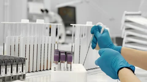 Lab technician isolating red blood cells with pipette in hematology laboratory. Stockbeeldmateriaal 320885733