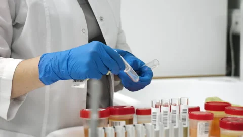 Lab technician labeling urine sample tube with barcode in medical laboratory. Stock Footage 320885343