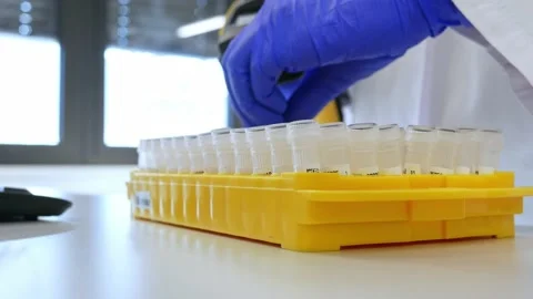 Lab technician or medical assistant scans patient samples into the patient Stock Footage 150972731