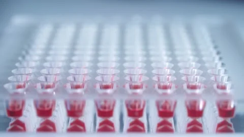 Lab technician performs a blood test in the laboratory. Coronavirus positive Video stock 130888897