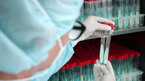 Lab technician selecting test tubes from rack in medical laboratory. Stockbeeldmateriaal 347790385