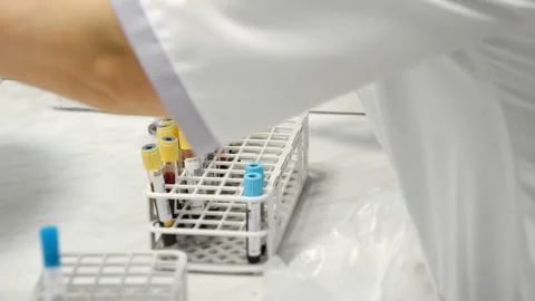 Lab technician sorting incoming blood samples for clinical analysis. Vídeo Stock 321576821