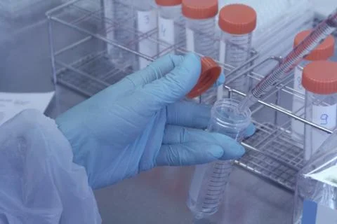 Lab technician takes sample from test tube for test Stock Photos