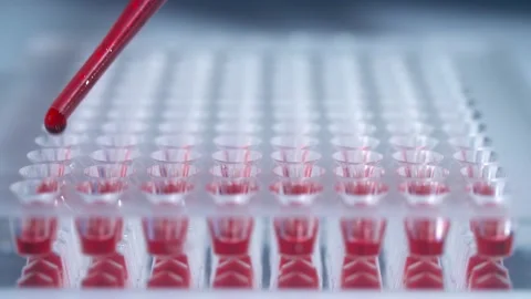Lab technician testing blood samples on hospital, hands close up. Development Video stock 130692132