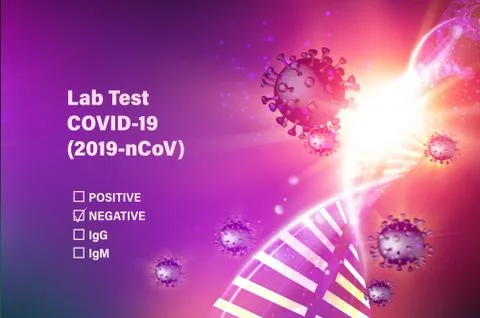 Lab test check list on covid-19. Computer model of Coronavirus in futuristic red Stockillustratie