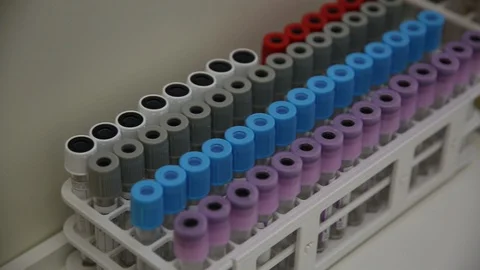 Lab tubes Video stock 128534414