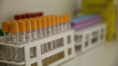 Lab tubes Video stock 128534524