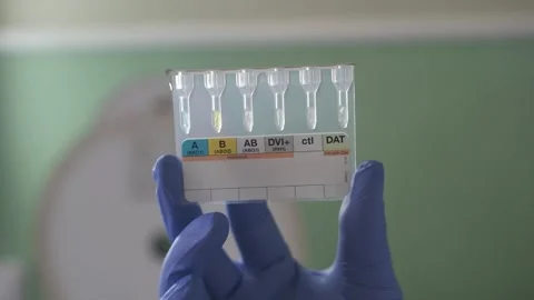 Lab worker in disposable gloves holding a test tube with blood samples Stock Footage 167658234