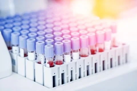 Lab worker preparing test blood for detection of antibodies and infections Stock Photos