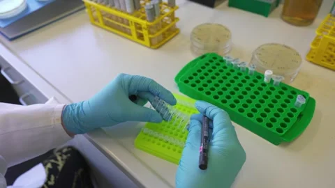 Labeling tubes of bacterial colonies for sowing on solid nutrient media 库存影片 263213592