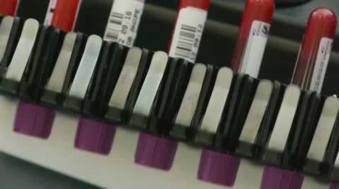 Laboratory analysis of blood Stock-Footage 12363397