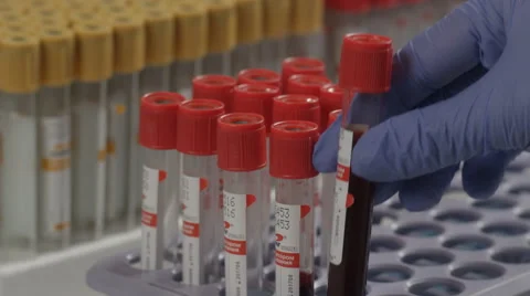 Laboratory analysis of blood 動画素材 62712373