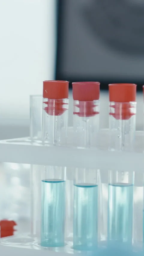 Laboratory analysis utilizing test tubes and pipettes plays an essential role in Stock Footage 293208593