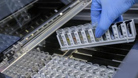 Laboratory assistant is analyzing fluid, gloved hand Stock Photos
