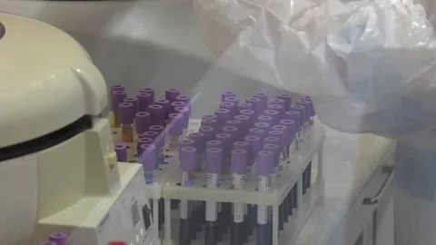 Laboratory assistant, blood in test tubes, medical tests Video stock 130616191