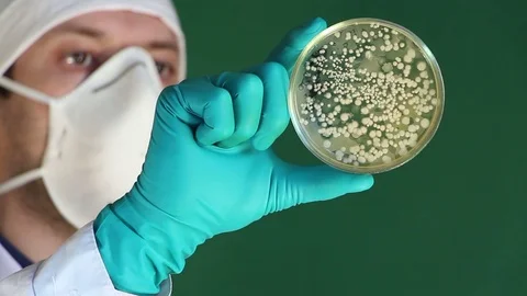 Laboratory assistant counts  microbial plaques  in petri dish bacterial agar Stock Footage 73551264