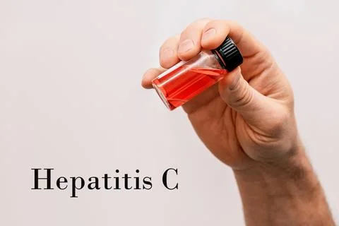 Laboratory Assistant Hand Holds test tube, Medical Problem of Hepatitis C Vir Fotos Stock