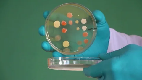 Laboratory assistant opens petri dish bacterial agar Stock Footage 73170695