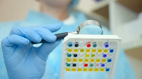 A laboratory assistant or a scientist examines through a magnifying glass Stock Footage 99951004