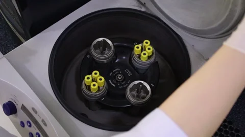 Laboratory assistant puts a urine test into the machine Stock Footage 283794251