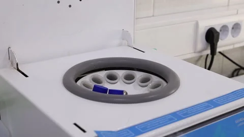 Laboratory assistant puts urine test into machine Stock Footage 283794275