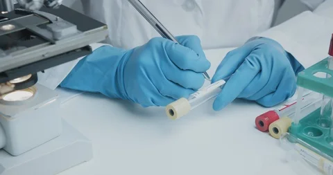 Laboratory assistant signs pen test tubes to collect analysis and further Vidéo 121617483