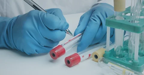Laboratory assistant signs pen test tubes to collect analysis and further Stock Footage 121617993