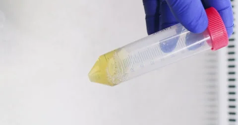 Laboratory assistant studies consistency of yellow fluid in tube Stock Footage 310314915