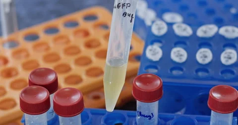Laboratory assistant takes test tubes to check yellow liquid Stock Footage 274653743