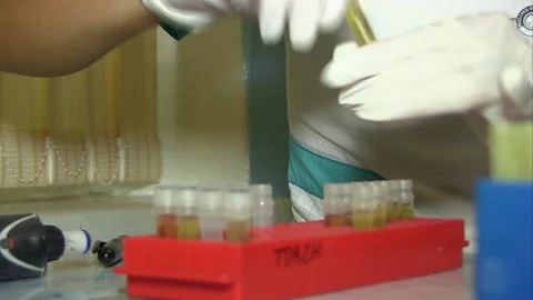 Laboratory. Blood test Stock Footage 114008865