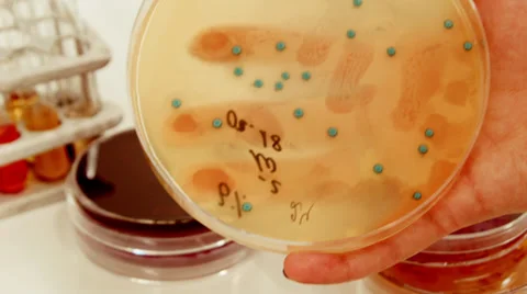 Laboratory cultures closeup Vidéo 37344407