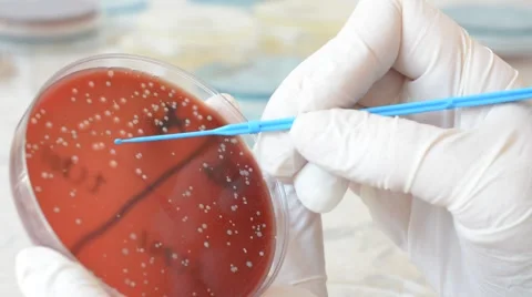 Laboratory doctor using inoculation loop to isolate Staphylococcus bacteria Stock-Footage 59736931